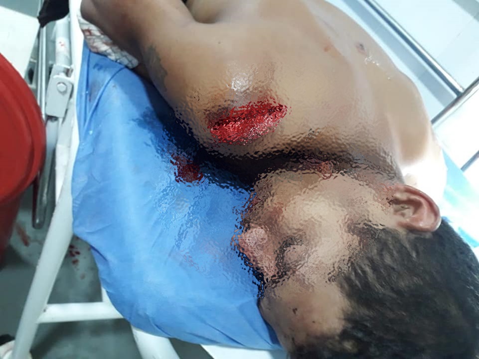 Un lesionado con machete se registró esta madrugada en Baranoa 1 140065901 210705814079305 6330183011443727984 n