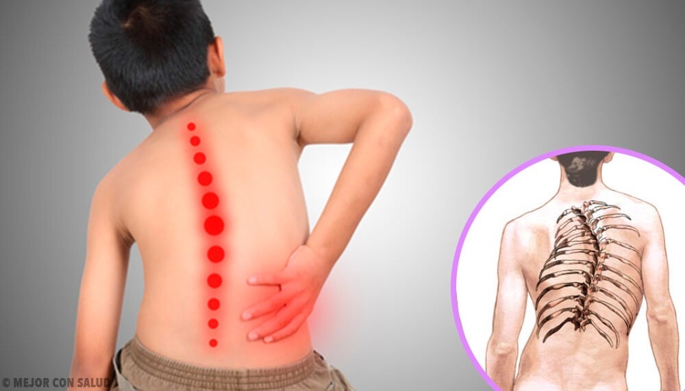 La atrofia muscular espinal: Diagnóstico y atención multidisciplinaria, claves de la enfermedad 1 atrofia muscular 1