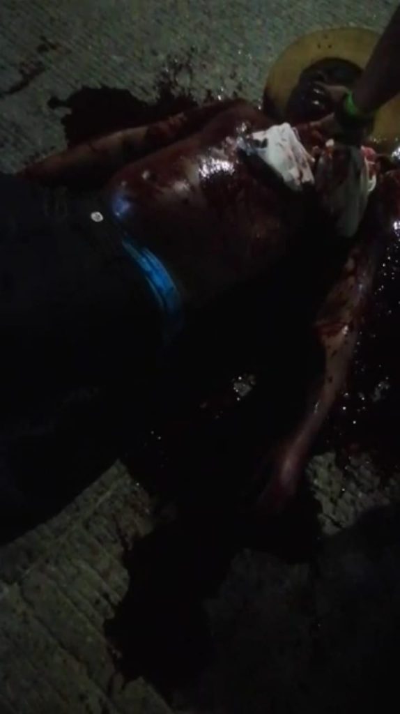 Un muerto la madrugada de este martes en el barrio Las Malvinas 2 f18ee30e 960f 472d b0c3 b45811d580d3
