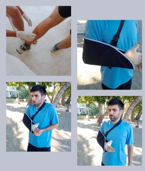 Turista español abandona gira en Santa Marta tras ser gravemente herido en ataque violento 1 456045481 818617610419237 6110465539976646886 n