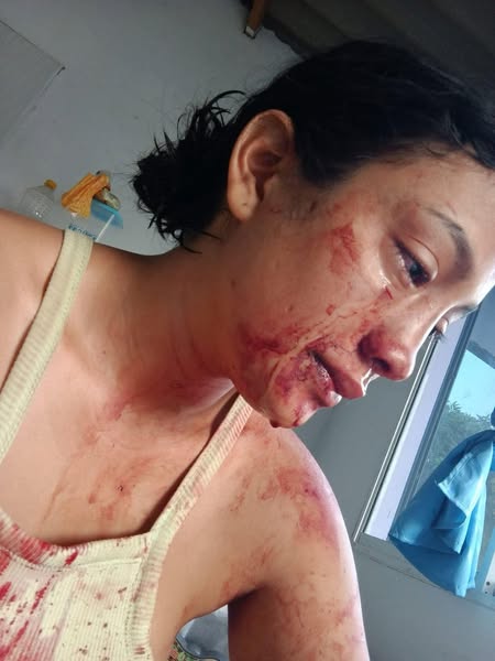 Hombre acusado de agredir a su pareja rechaza las acusaciones y anuncia acciones legales por difamación 3 480688744 122124780482625217 3550100559804050910 n
