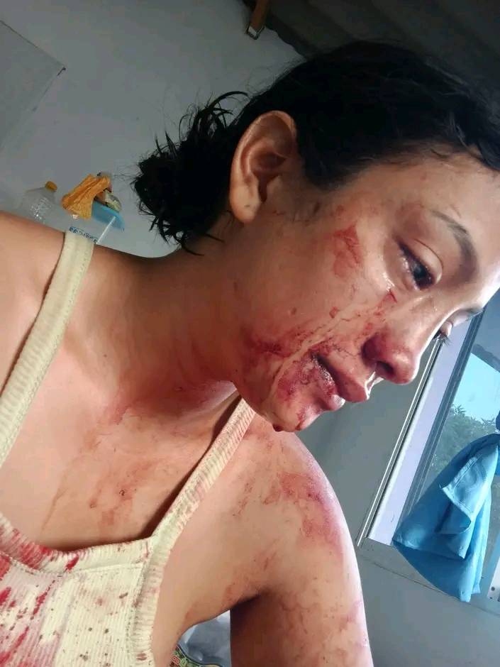Mujer denuncia amenazas y agresión por parte de su ex pareja: la fiscalía no responde 2 IMG 20250223 WA0013