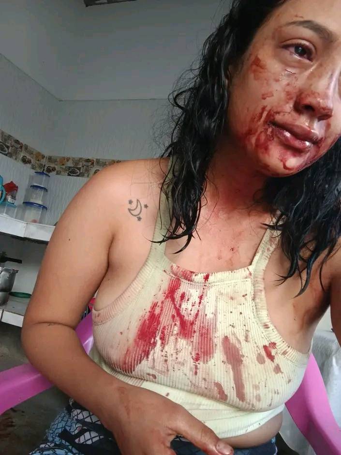 Mujer denuncia amenazas y agresión por parte de su ex pareja: la fiscalía no responde 1 IMG 20250223 WA0014